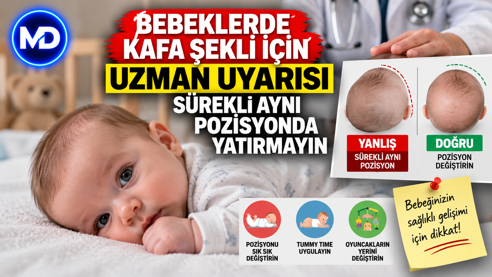 Bebeklerde kafa şekli için uzman uyarısı: Sürekli aynı pozisyonda yatırmayın