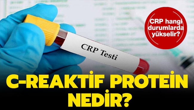 Kandaki CRP Yüksekliği Ne Demektir? Nasıl Düşürülür?
