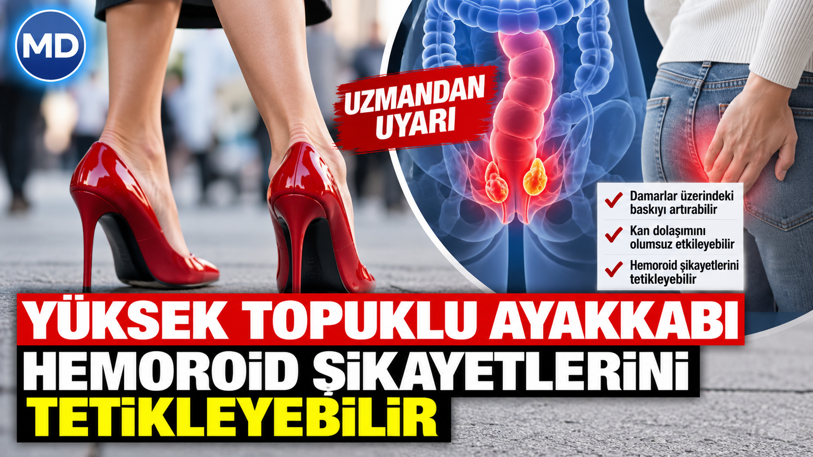 Uzmandan uyarı: Yüksek topuklu ayakkabı hemoroid şikâyetlerini tetikleyebilir