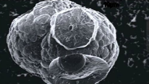 Yanıcı buzun kabarcıklarında mikrop keşfedildi.