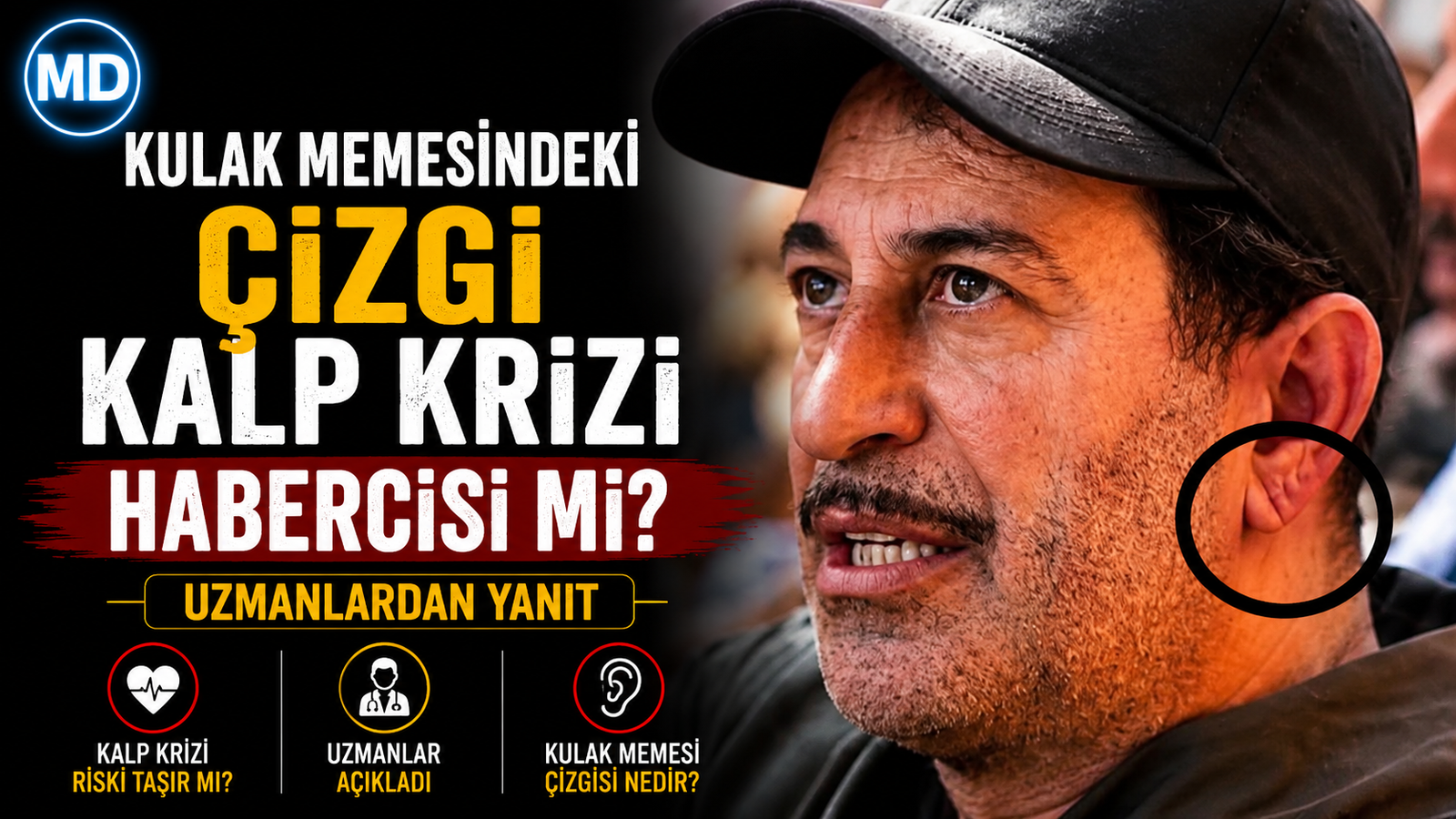 Kulak memesindeki çizgi kalp krizi habercisi mi? Uzmanlardan yanıt