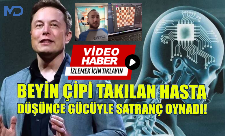 Elon Musk'tan Neuralink paylaşımı. Beyin çipi takılan hasta satranç oynadı