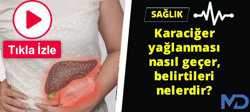 Karaciğer Yağlanması Neden Olur? Belirtileri & Tedavisi