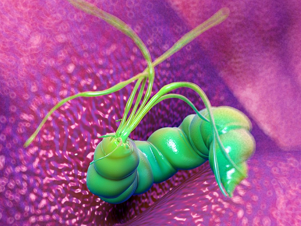 Helicobacter pylori nedir? Belirtileri nelerdir?