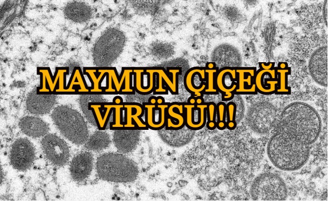 Maymun çiçeği virüsü alarmı: 13 ülkede görüldü 