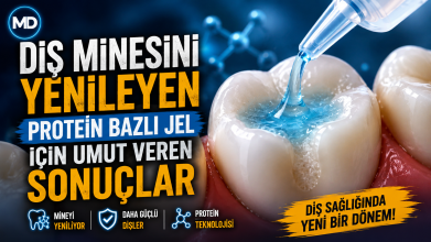 Diş minesini yenileyen protein bazlı jel için umut veren sonuçlar