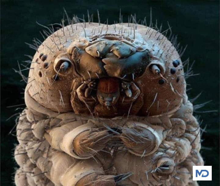 Demodex Nedir, Neye Sebep Olur, Nasıl Tedavi Edilir?