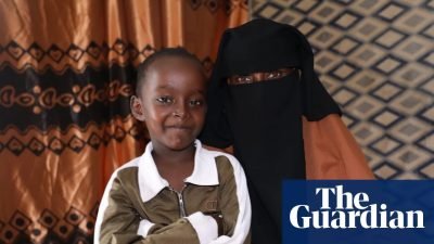 Somali Boy Undergoes Life-Changing Surgery Funded by Readers After US Airstrike