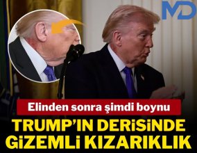 Trump’ın Boynundaki Kızarıklık Sosyal Medyayı Salladı: İşte Beyaz Saray’ın Açıklaması