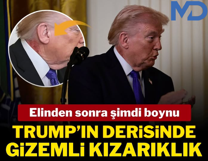 Trump’ın Boynundaki Kızarıklık Sosyal Medyayı Salladı: İşte Beyaz Saray’ın Açıklaması